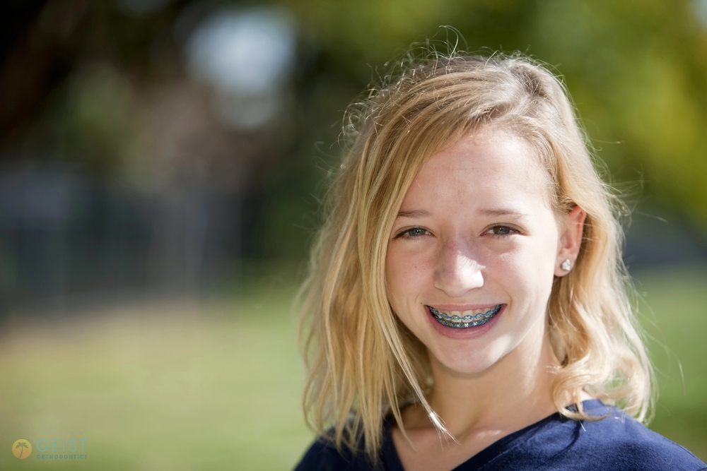 Blonde girl outdoors pointing at her braces with a big smile, highlighting braces for overbite in Indianapolis, IN care for kids.