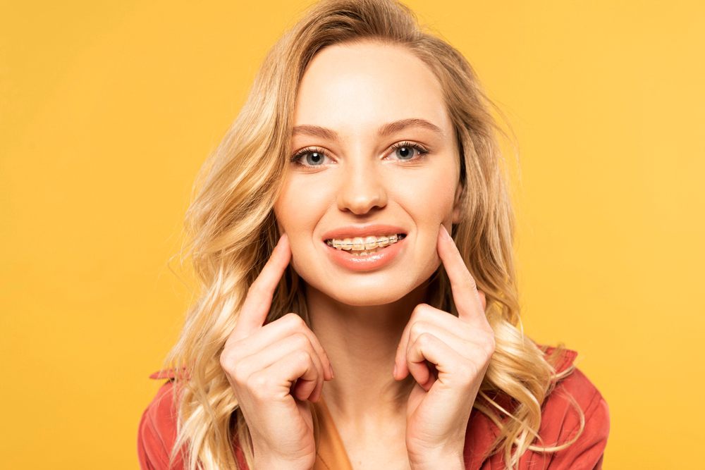 smiling blonde woman clear braces looking camera isolated yellow - overbite vs underbite in Indianapolis, IN. 